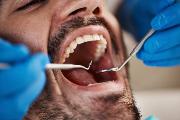 Full Mouth Reconstruction in Lakes West, CT